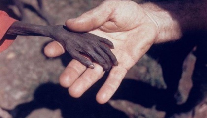 Emaciated Hand in Old One