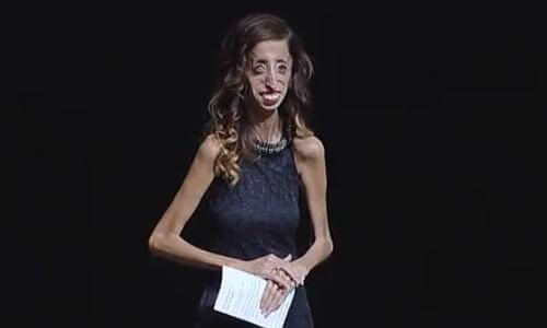 lizzie velasquez standing