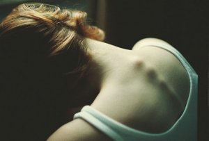 Anorexia: When Being Too Skinny Is Just the Tip of the Iceberg