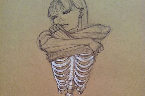 woman with anorexia