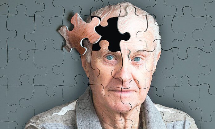 5 Warning Signs of Alzheimer's