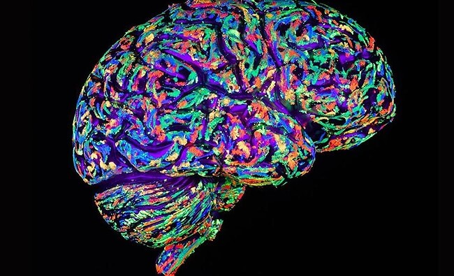 a colorful, reacting brain
