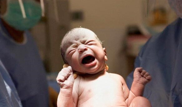 a baby being born