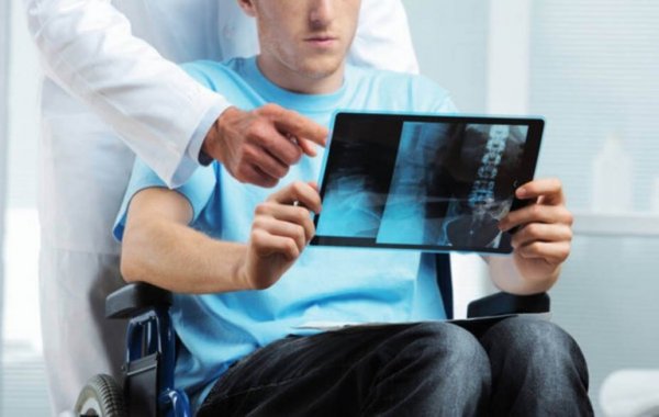 mężczyzna ze stwardnieniem rozsianym, patrząc na zdjęcie rentgenowskie