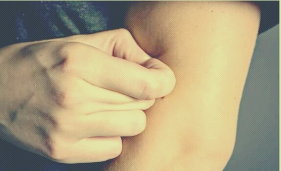 excoriation disorder or skin picking disorder