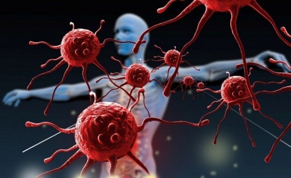 How Can You Strengthen Your Immune System?