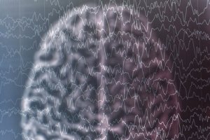 What Is Lennox-Gastaut Syndrome?