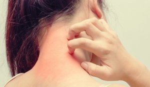 Atopic Dermatitis and Stress -  What's the Relationship?