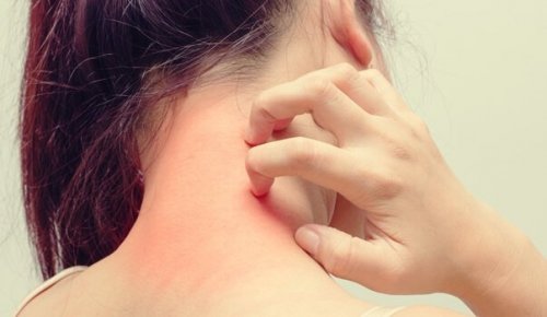 Atopic Dermatitis and Stress –  What’s the Relationship?