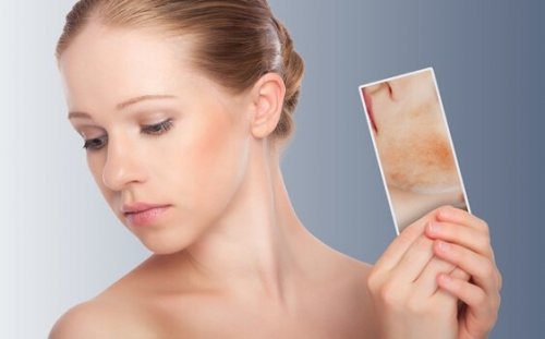 woman with picture of dermatitis