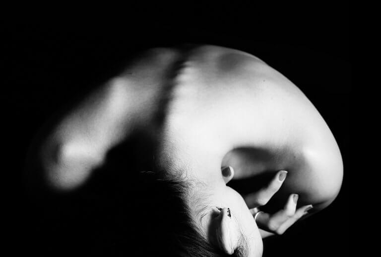 anorexic woman