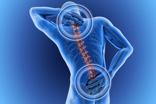 Back and neck pain.