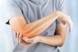 Rheumatoid Arthritis: Symptoms, Causes, and Treatment