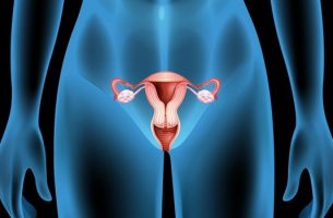 ovarian cysts