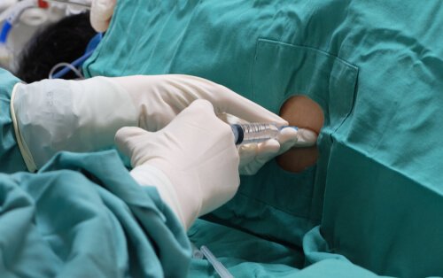 A doctor performing a lumbar puncture.