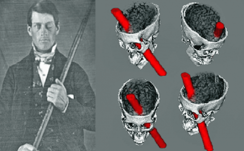 Phineas Gage and a representation of his brain injury.