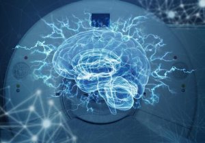 The Differences Between the CAT Scan and the MRI Scan