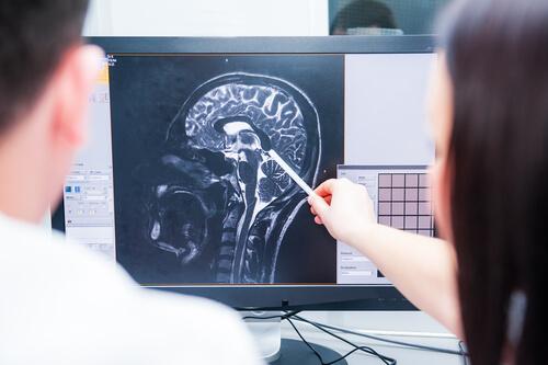 læger, der kigger på scanningsbillede af hjerne