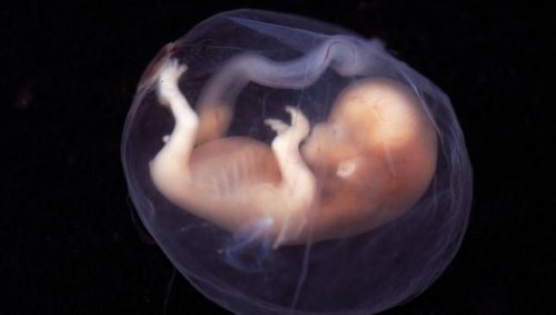 A fetus in the womb.
