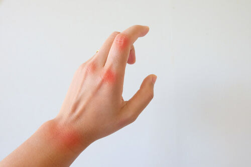 Joint pain.