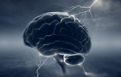 Brain with migraines and dopamine.