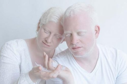 Couple living with albinism.