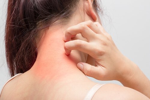 Atopic dermatitis often manifests itself on joints.