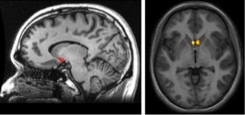 Location of the nucleus accumbens.