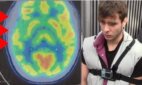 A brain scan of a psychopath.