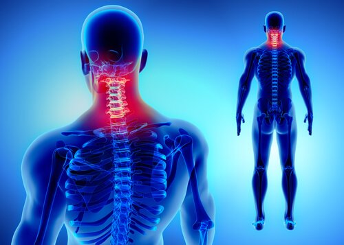 A man with cervical pain.