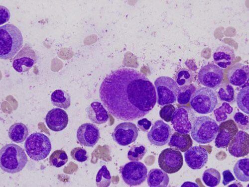 Lymphocytes.