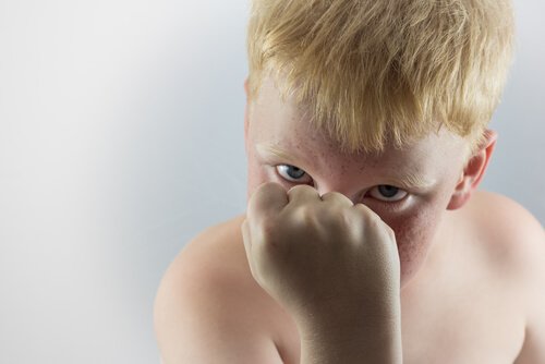 Aggressive child.