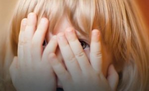 Facial Malformations and Their Unexpected Effects