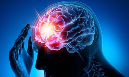 Man with a headache due to intracranial aneurysm.