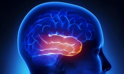 Temporal lobe.