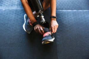 What's Phantom Limb Syndrome?