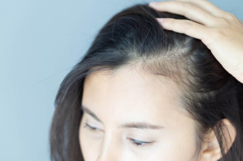 The Psychological Repercussions of Alopecia in Women