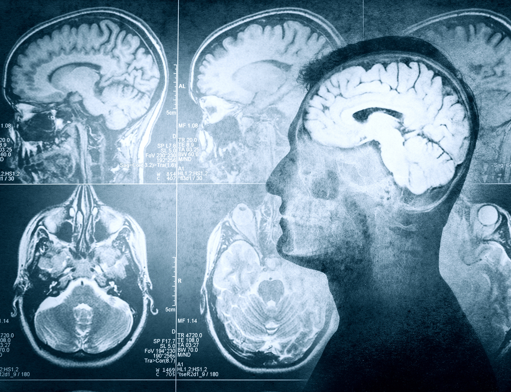 The Cognitive And Affective Empathy Test Exploring Your Mind