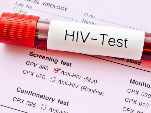 An HIV test.