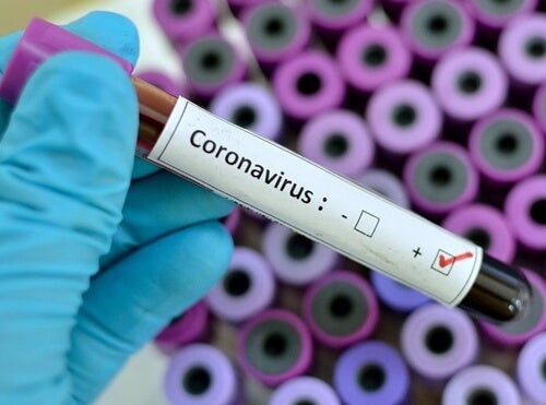 A sample of coronavirus.