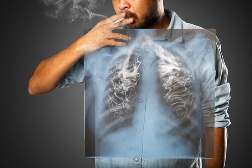 The effects of smoking.