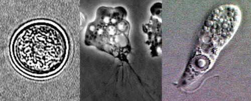Various pictures of amoeba on petri-dish.