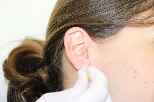 Acupuncture treatment for degenerative diseases.