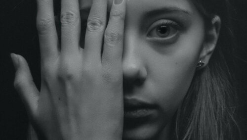 A woman covering an eye.