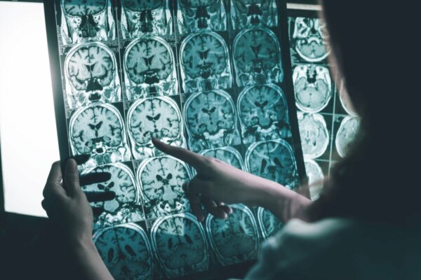 Brain Wave Stimulation for People with Alzheimer's