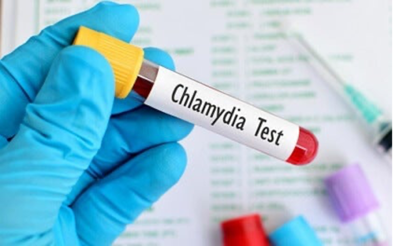 Understanding Chlamydia: Symptoms and Treatment