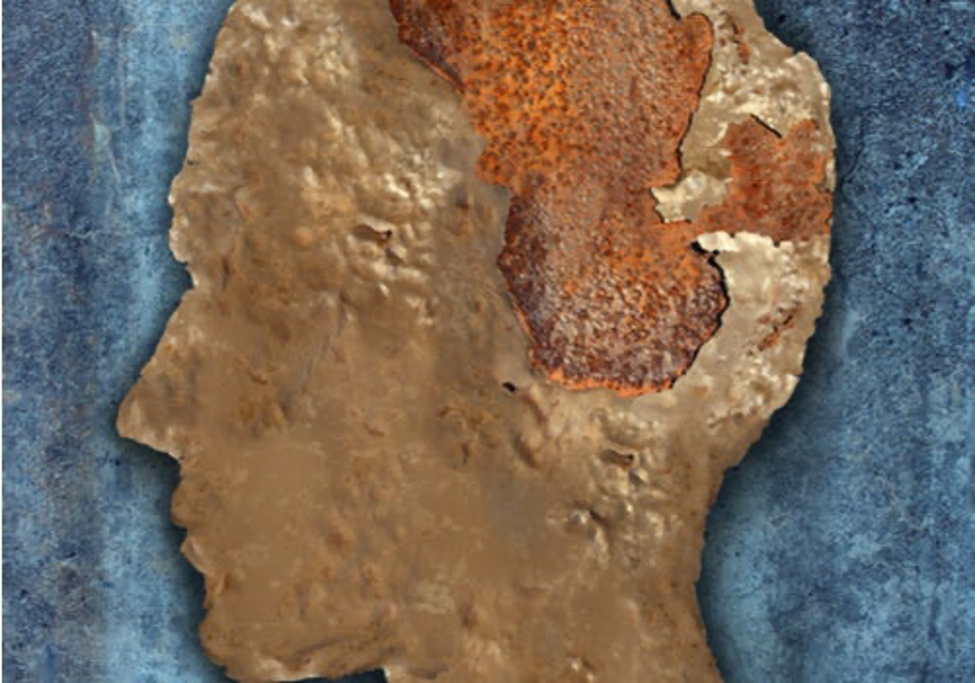 Mad Cow Disease or Spongiform Encephalopathy