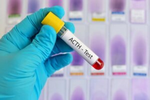 Adrenocorticotropic Hormone: Characteristics and Functions
