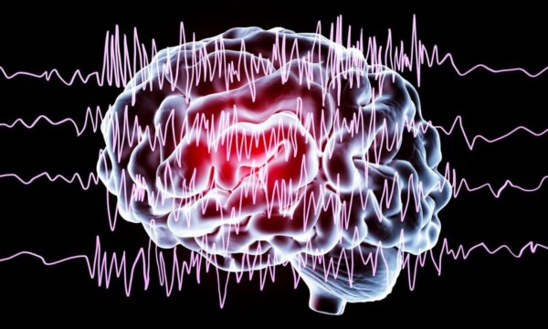 Waves on a brain.