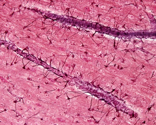 A photo of astrocytes.